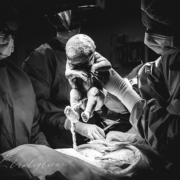 Elective c section